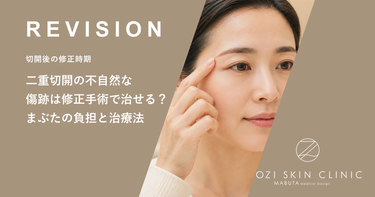 二重切開の不自然な傷跡は修正手術で治せる?まぶたの負担と治療法