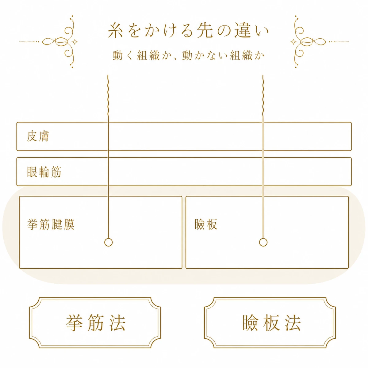 まぶたの層を帯で積み重ねて示し、挙筋法の糸が挙筋腱膜へ、瞼板法の糸が瞼板へ届くことを表した図解イラスト