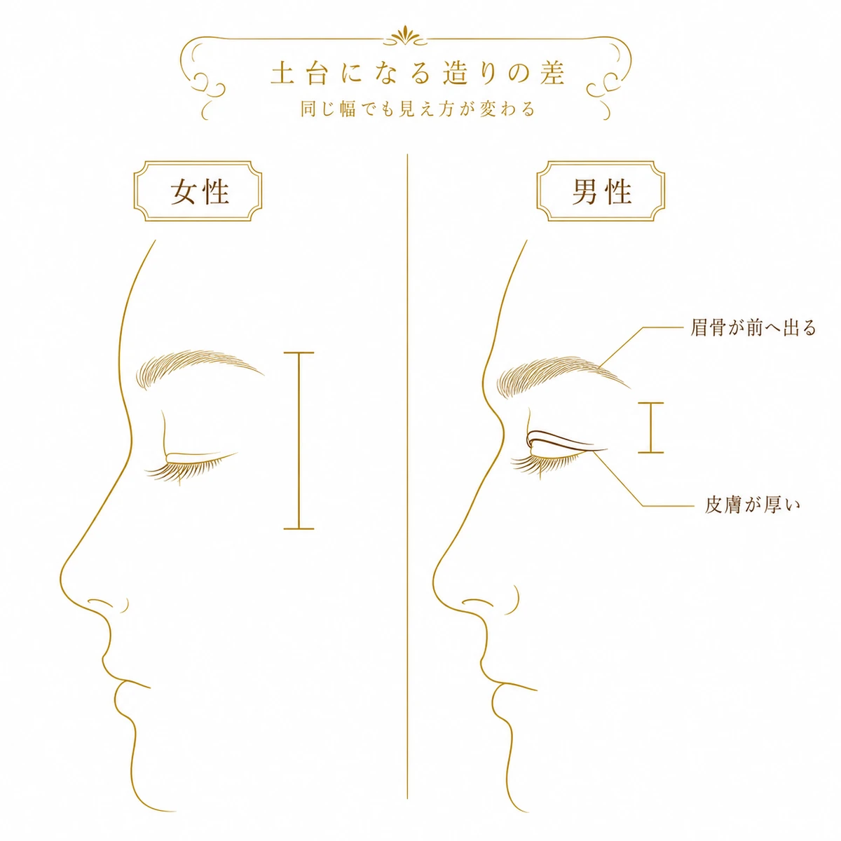 上まぶたの側面図を女性と男性で並べ、男性は皮膚が厚く眉骨が前へ張り出して眉と目の距離が詰まることを示した図解イラスト