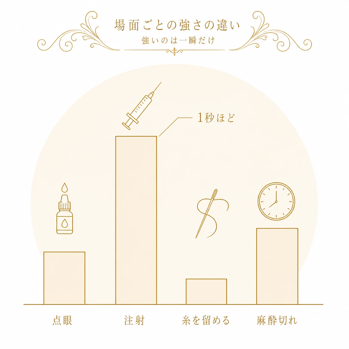 埋没法で痛みが出る4つの場面を左から並べ、麻酔の注射のときだけ強さが突出することを帯の高さで示した図解イラスト