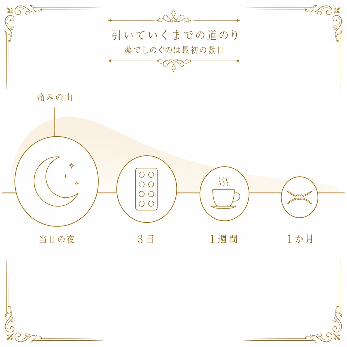 埋没法の術後の痛みが当日の夜から3日・1週間・1か月へと弱まっていくことを、小さくなる4つの丸と節目のアイコンで示した図解イラスト