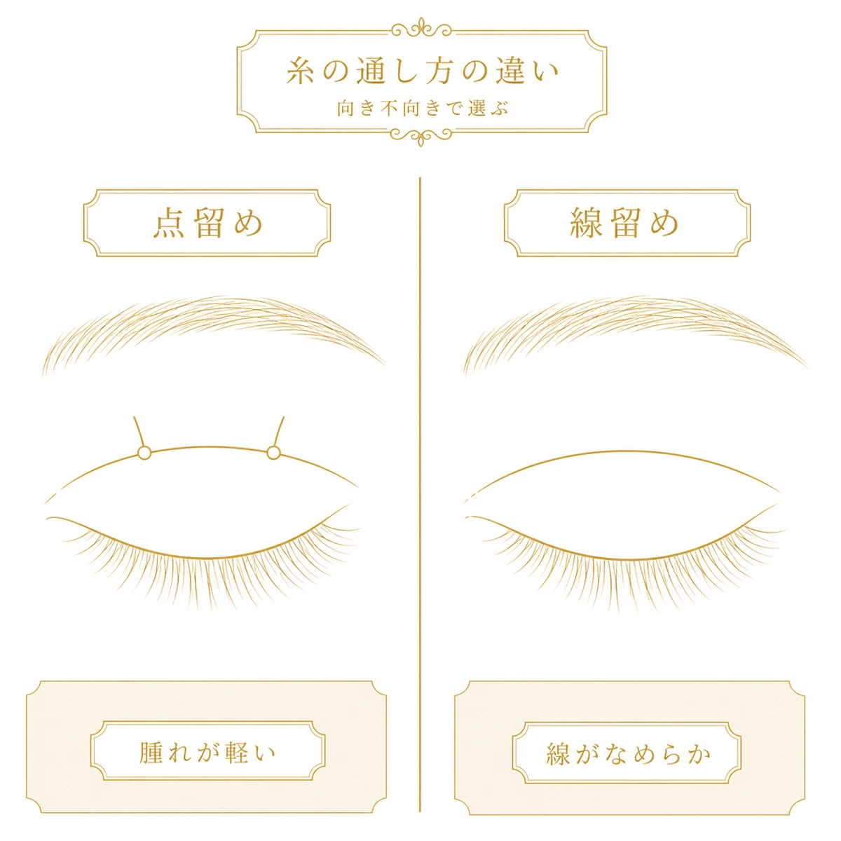 点留めと線留めの糸の通り方を左右に並べ、離れた点で留める形と一本の糸が連続して渡る形の違いを示した図解イラスト