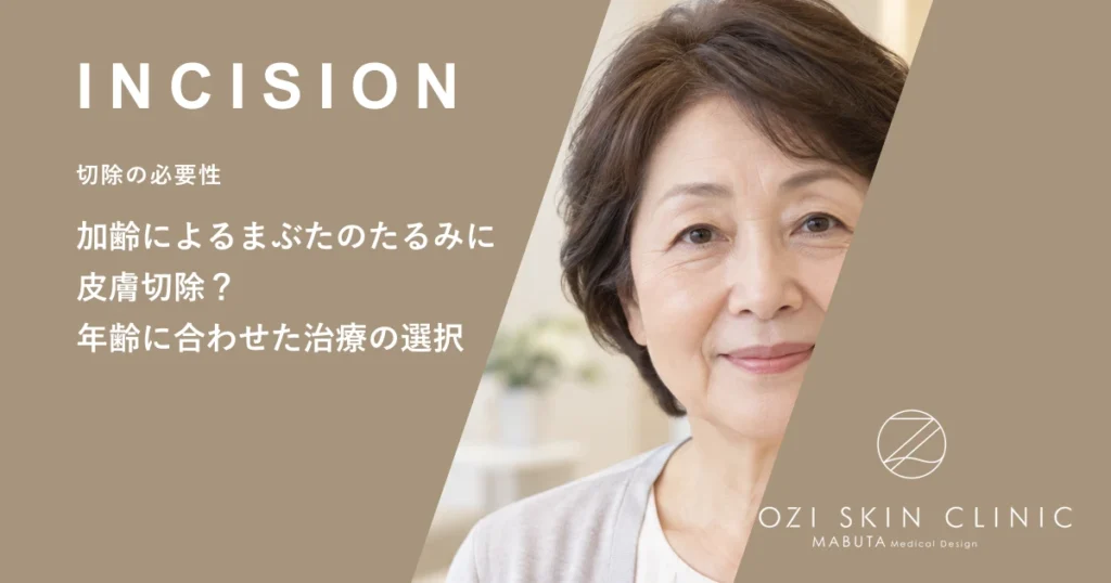 加齢によるまぶたのたるみに皮膚切除？年齢に合わせた治療の選択
