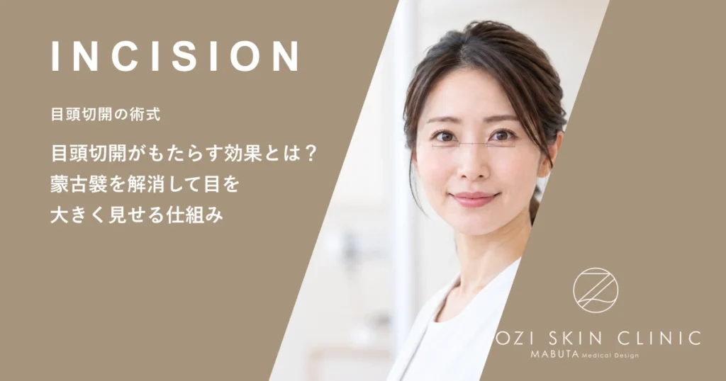 目頭切開がもたらす効果とは？蒙古襞を解消して目を大きく見せる仕組み