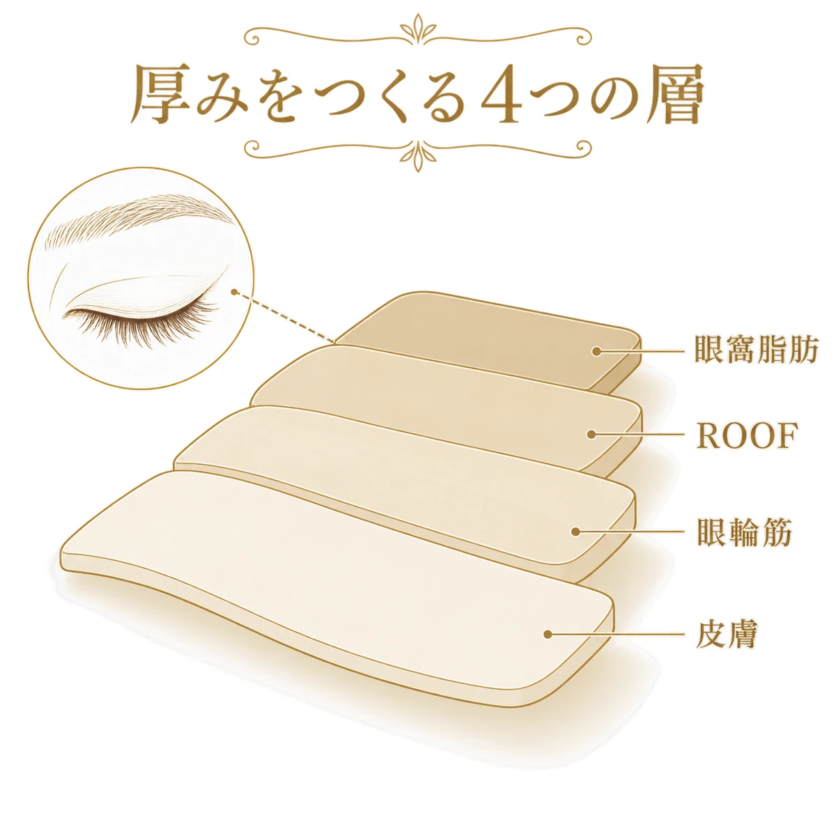 まぶたの厚みに関わる皮膚、眼輪筋、ROOF、眼窩脂肪の4層を重ねた模式図