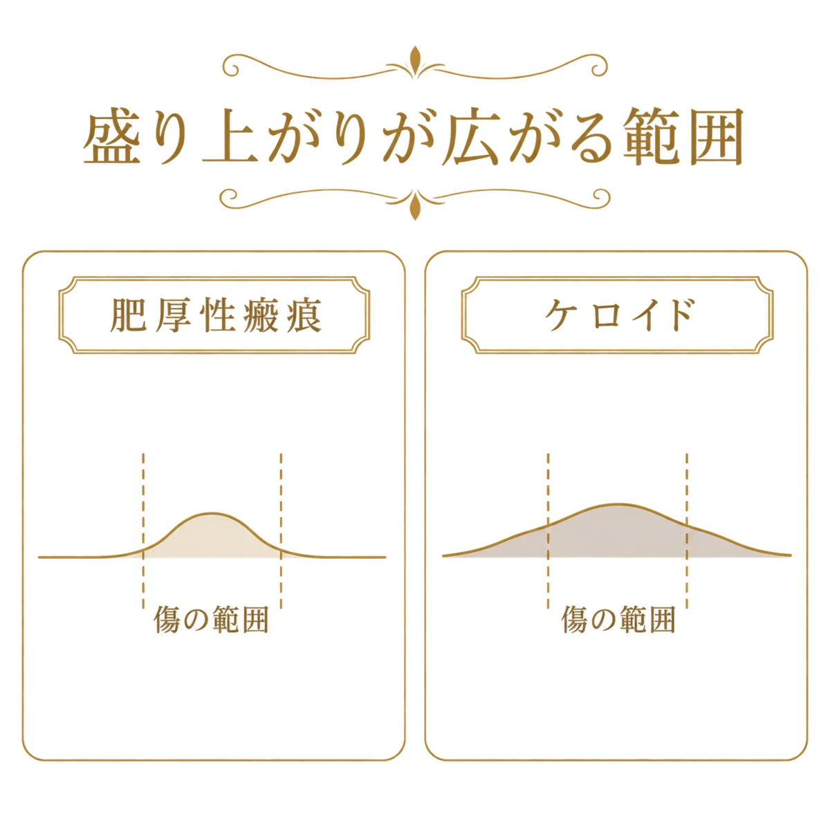 傷の範囲内に収まる肥厚性瘢痕と範囲を越えて広がるケロイドの比較図