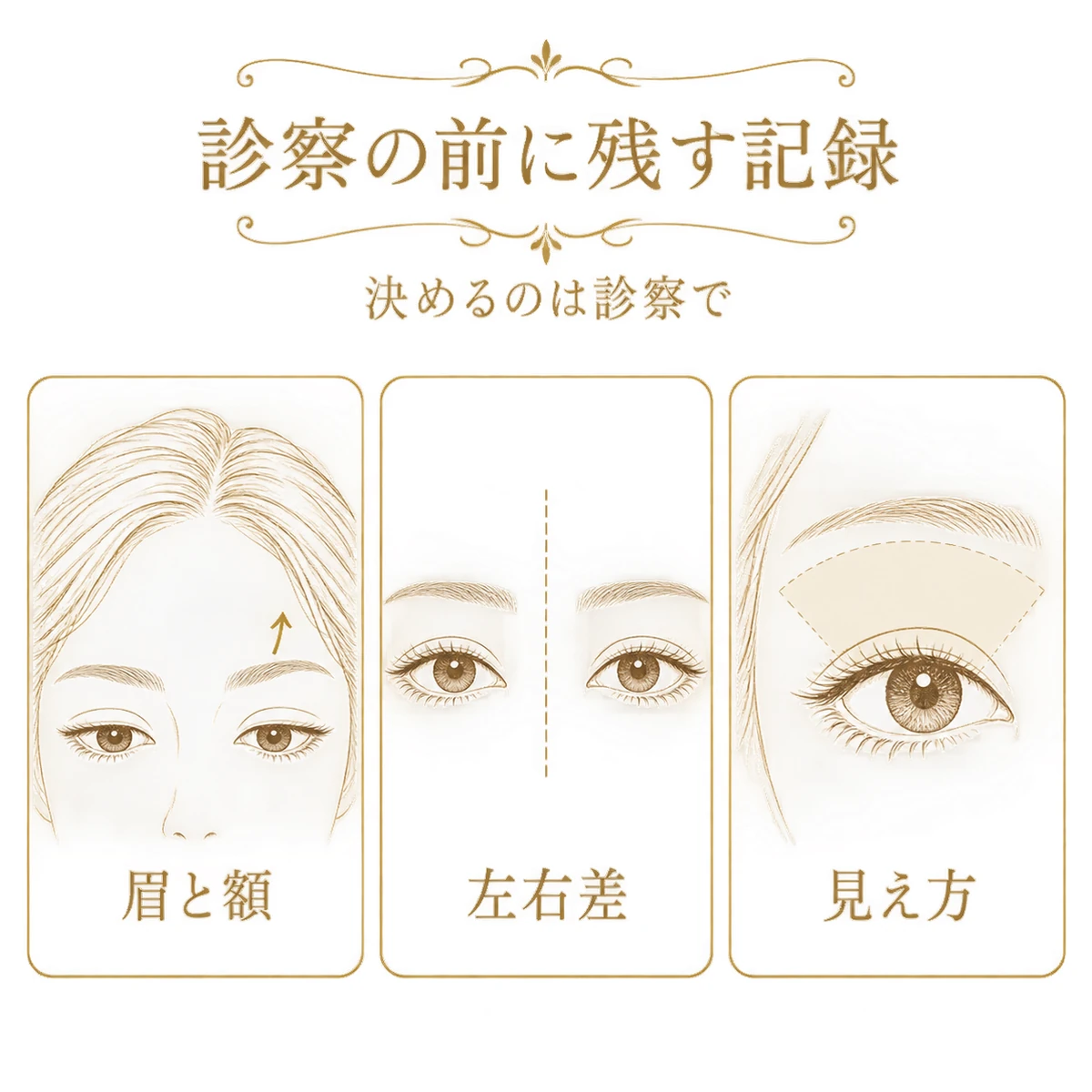 眉と額、左右差、見え方という、診察前に残す3つの記録を並べた図